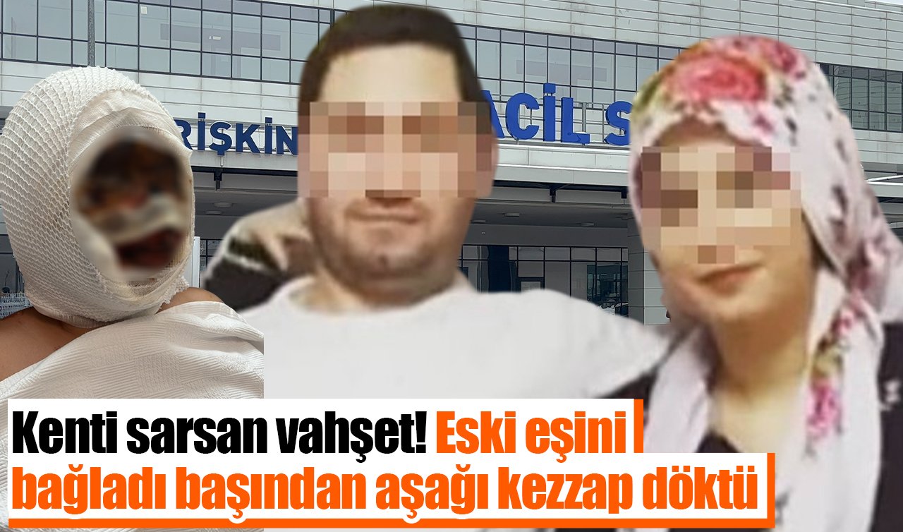 Kenti sarsan vahşet! Eski eşini bağladı başından aşağı kezzap döktü