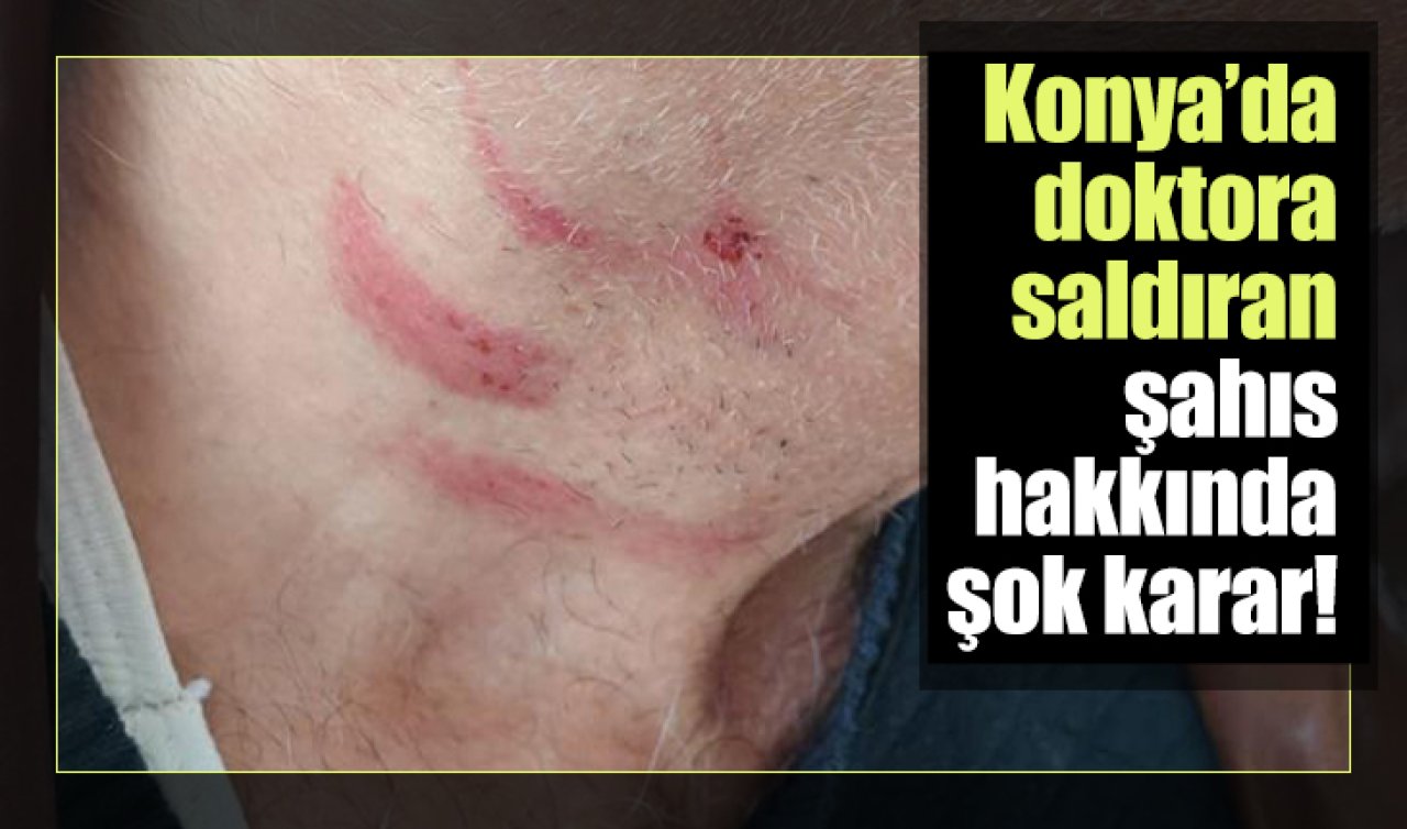 Konya’da doktora saldıran şahıs hakkında şok karar! 