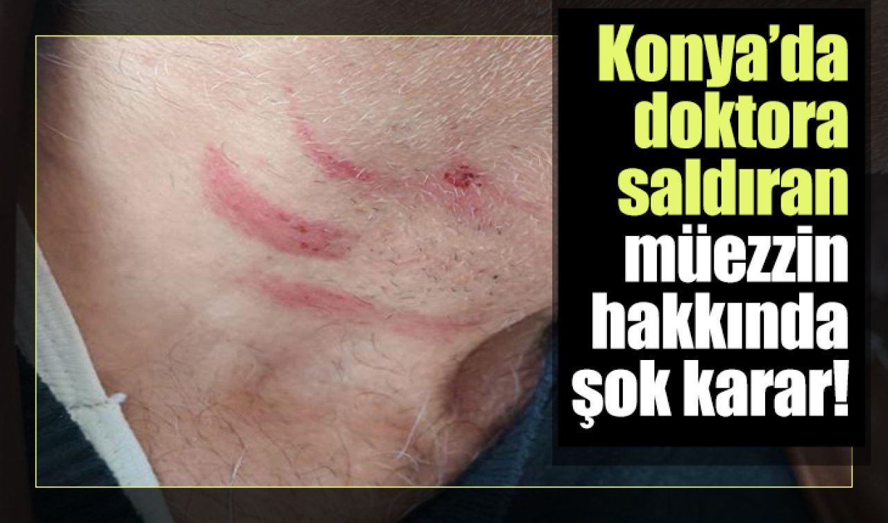 Konya’da doktora saldıran müezzin hakkında şok karar! 