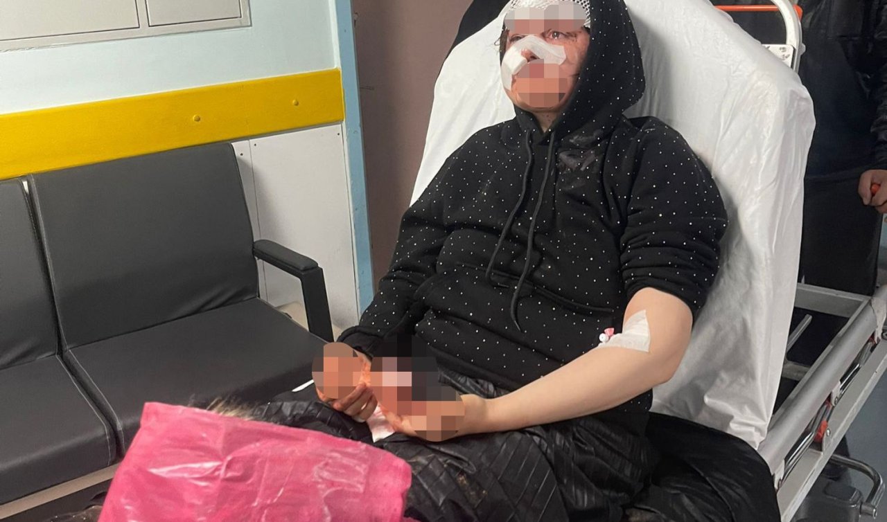 Karısını taşla darp etti! Boşanmak isteyen eşine dehşeti yaşattı