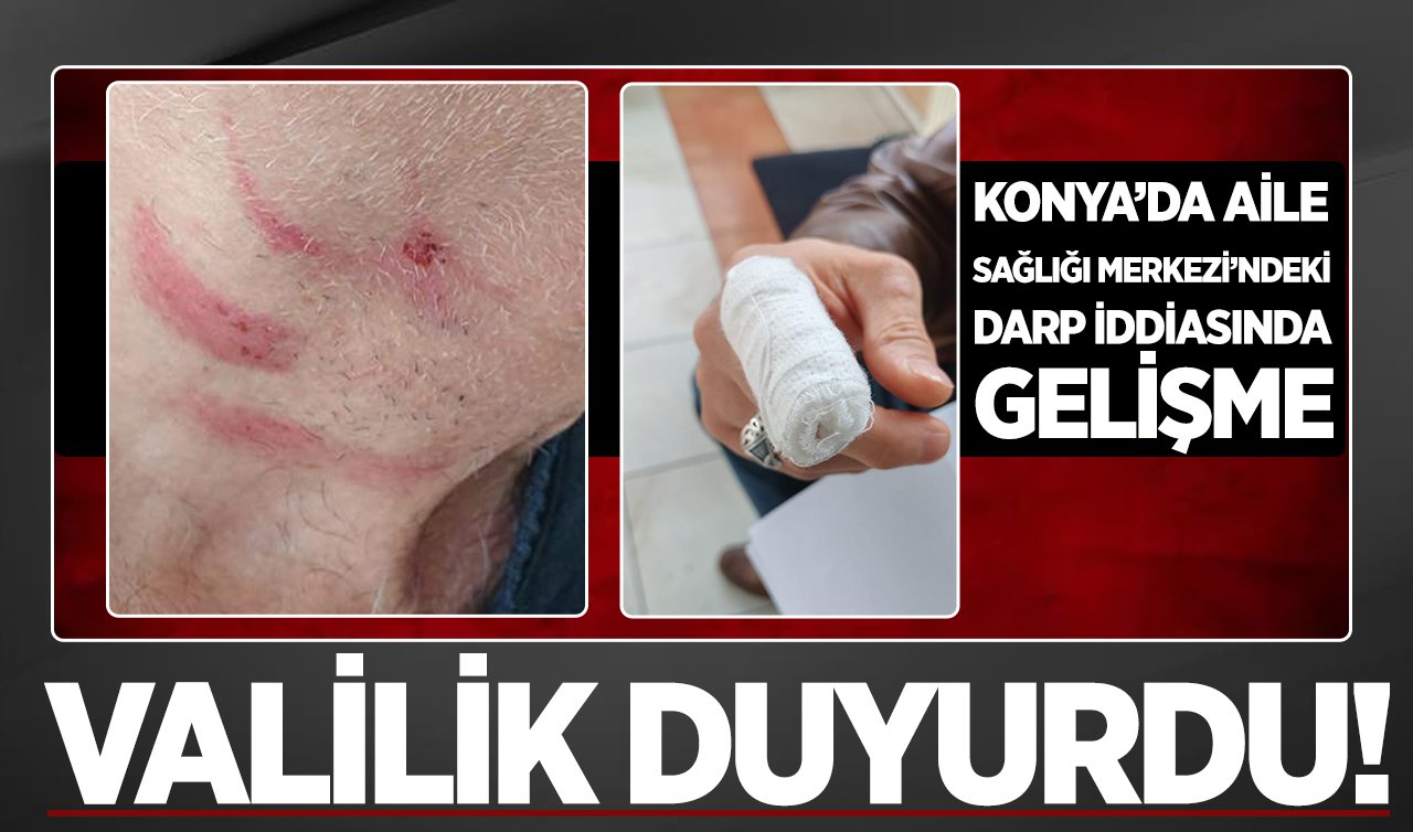 Konya’da Aile Sağlığı Merkezi’ndeki darp iddiasında gelişme: Valilik duyurdu!