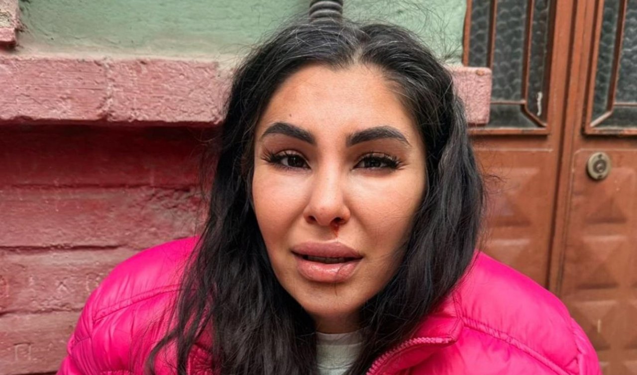 İlişkisini bitirmek istedi! Darbedilip burnu kırıldı