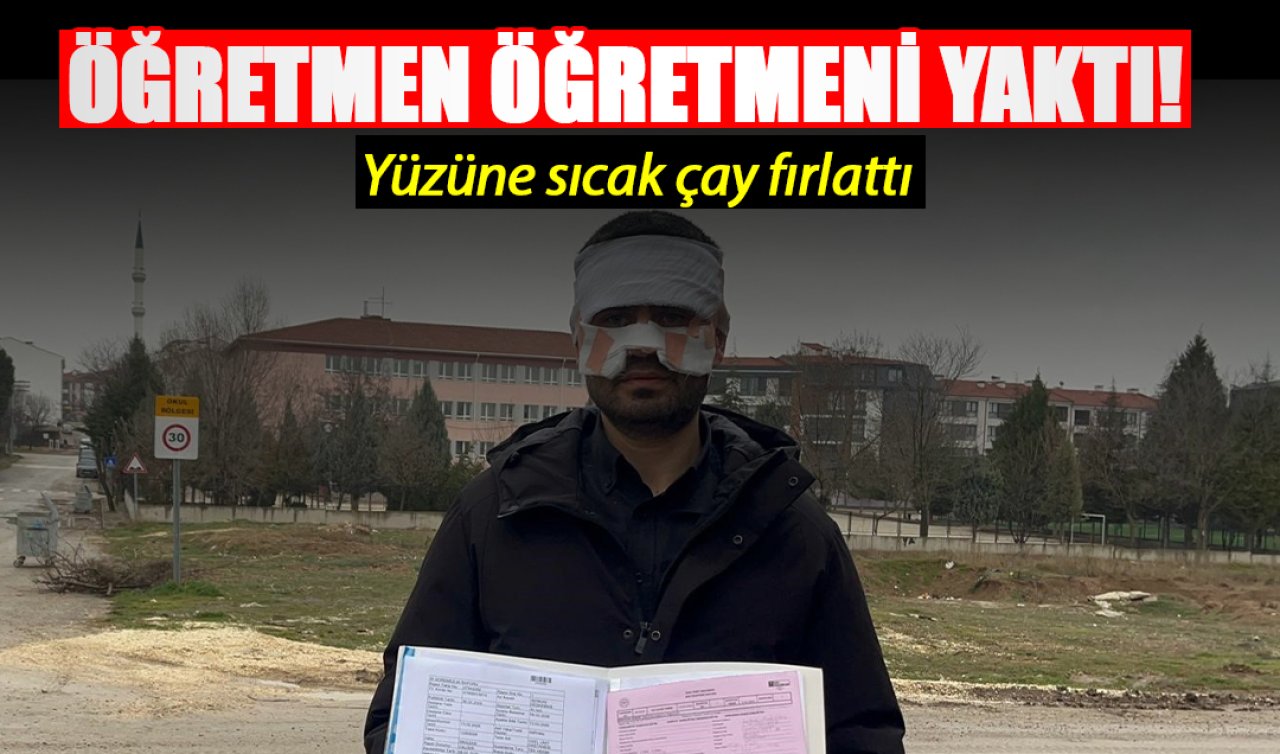 Öğretmen öğretmeni yaktı! Yüzüne sıcak çay fırlattı