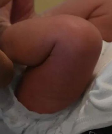 Sünnet edilen 27 günlük bebek kan kaybından hayatını kaybetti