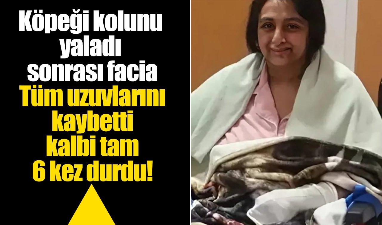 Köpeği kolunu yaladı sonrası facia: Tüm uzuvlarını kaybetti, kalbi tam 6 kez durdu!