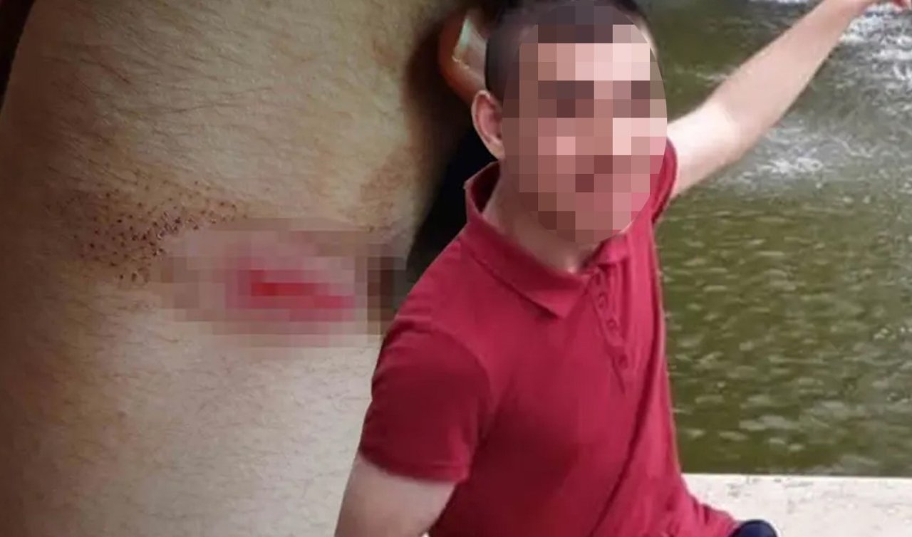 Bakımevinde ölüm davası: Engelli gence 30 kat fazla sakinleştirici verilmiş