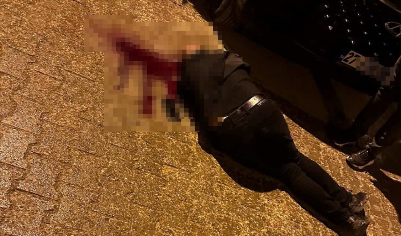 Sokakta yürürken tabanca ile başından vuruldu