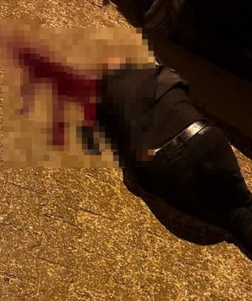 Sokakta yürürken tabanca ile başından vuruldu