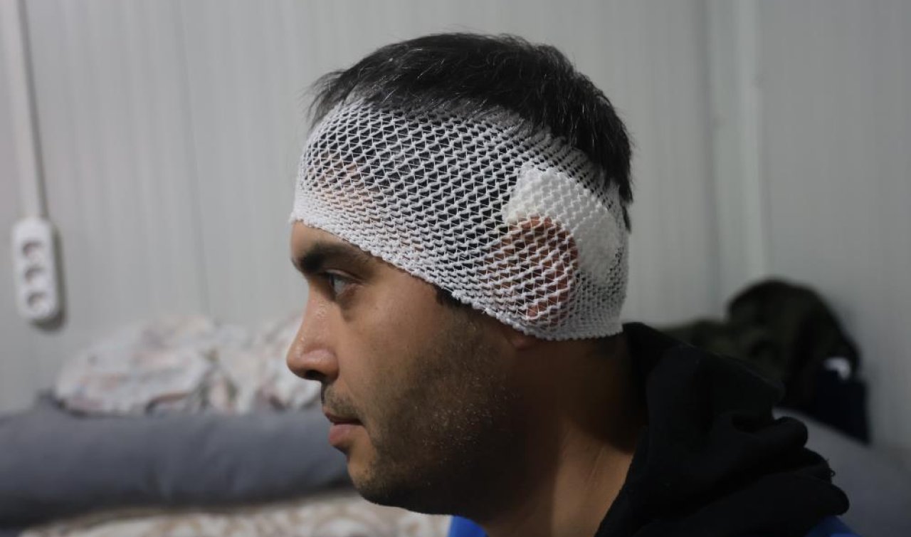 Bayram günü konteyneri delip geçen yorgun merminin kafasına isabet etmesiyle kabusu yaşadı