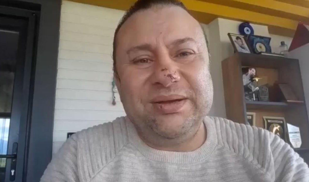 Pitbull saldırısına uğrayan ünlü sanatçı o anları anlattı: “Ben ölümden döndüm’’