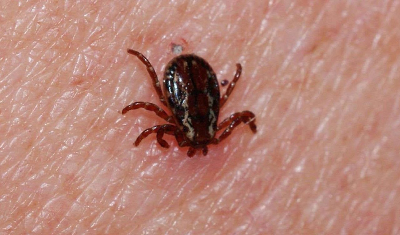 Kene ısırığı ölümle sonuçlandı 
