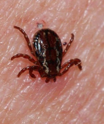 Kene ısırığı ölümle sonuçlandı 