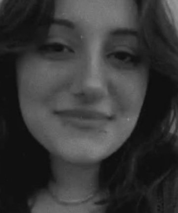Burun estetiği için ameliyat olan 23 yaşındaki genç kız hayatını kaybetti