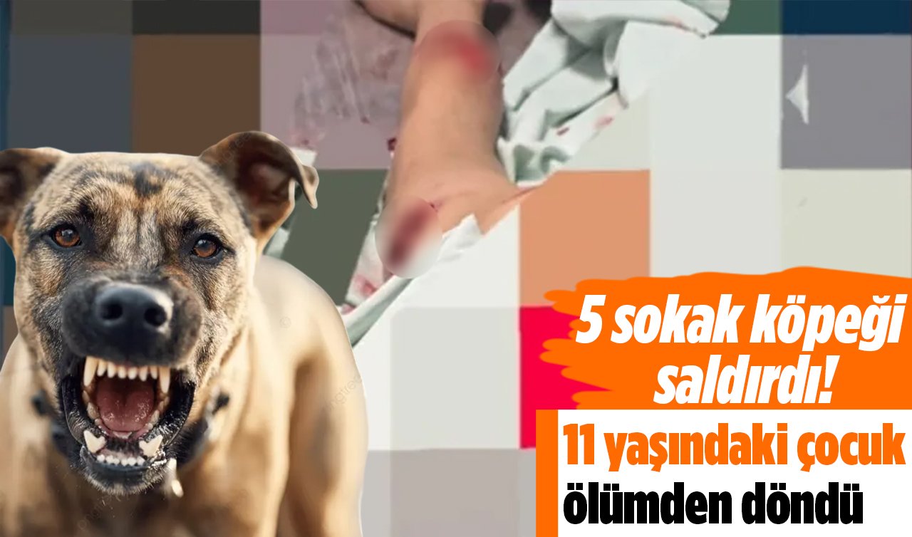 Sokak köpeği dehşeti: 11 yaşındaki çocuk ölümden döndü
