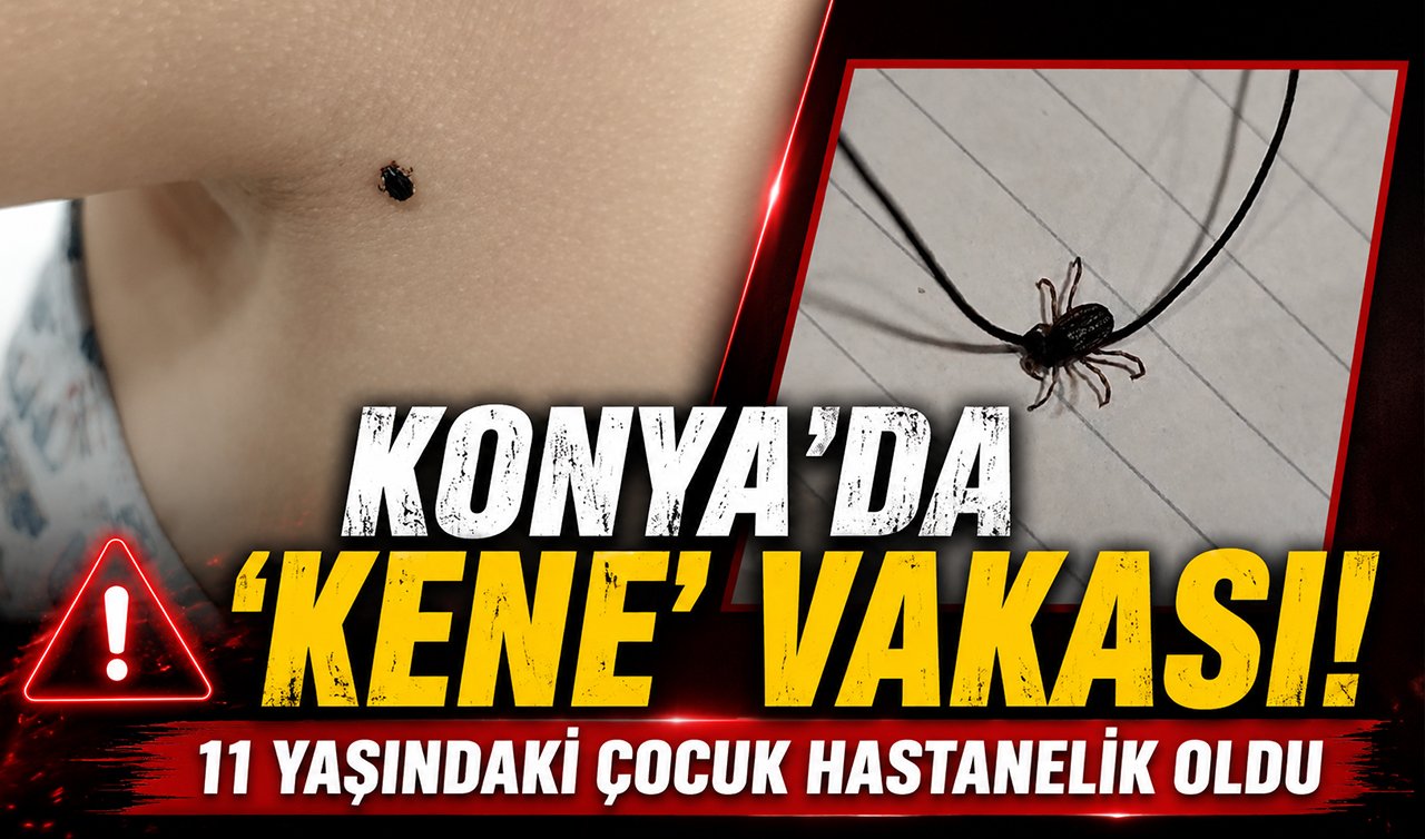 Konya’da “kene’’ vakası! 11 yaşındaki çocuk hastanelik oldu