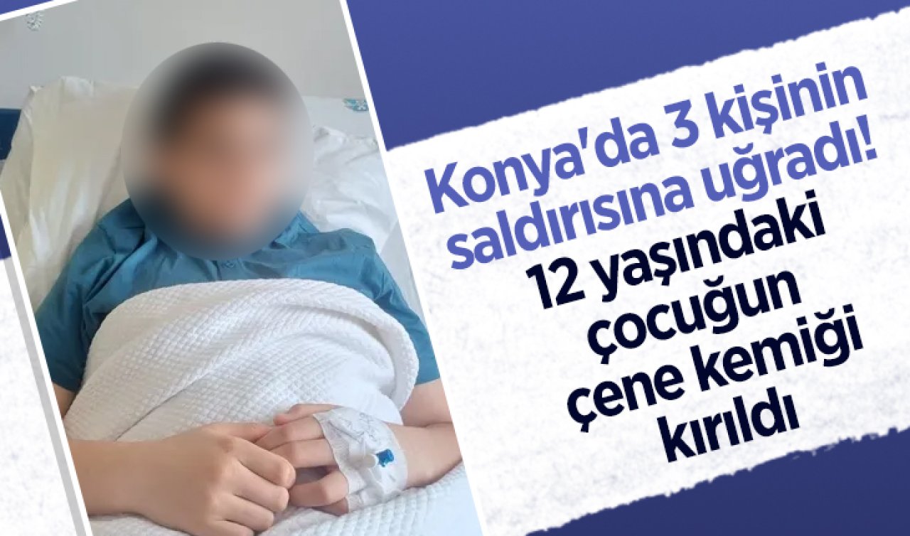 Konya’da 3 kişinin saldırısına uğradı! 12 yaşındaki çocuğun çene kemiği kırıldı 