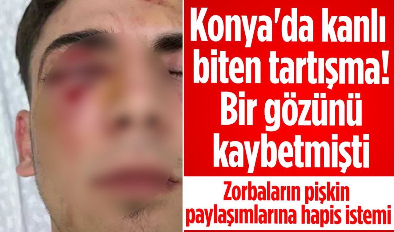Konya’da kanlı biten tartışma! Bir gözünü kaybetmişti: Şüphelilerin “pes’’ dedirten paylaşımı ortaya çıktı 