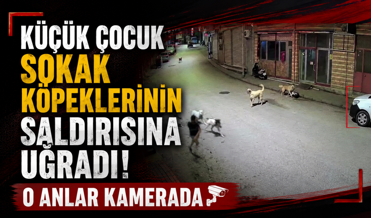 Küçük çocuk sokak köpeklerinin saldırısına uğradı