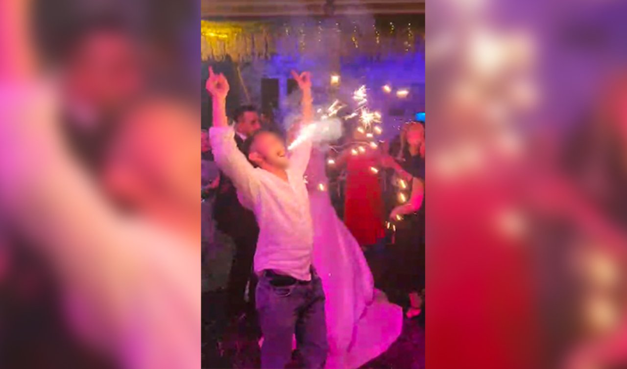 Düğünde ağzıyla tuttuğu meşale yüzünde patladı